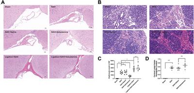 Dobutamine promotes the clearance of erythrocytes from the brain to cervical lymph nodes after subarachnoid hemorrhage in mice